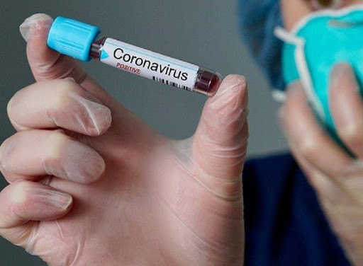 Coronavirus, al Monaldi sei contagi tra il personale
